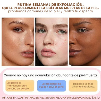 QUARXERY: Gel aclarador para la piel